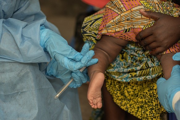 Nurses take samples from a child with potential MonkeyPox at the MonkeyPox isolation unit run by Medair at Nyirangongo General Hospital.