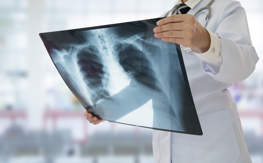Das Röntgenbild eines Patienten (Symbolbild).