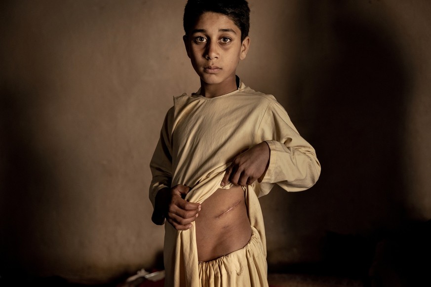 ACHTUNG: SPERRFRIST 20. APRIL 11:00 UHR. - HANDOUT - 19.01.2022, Afghanistan, ---: WORLD PRESS PHOTO STORY OF THE YEAR
The Price of Peace in Afghanistan - Mads Nissen, Denmark, Politiken/Panos Picture ...