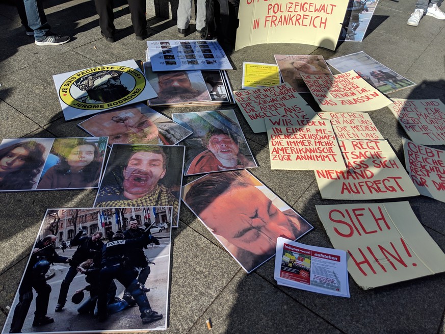 Die Demonstranten haben Fotos von Menschen mitgebracht, die bei den französischen Protesten von der Polizei verletzt wurden.