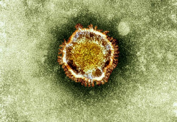 Coronavirus, SARS |
