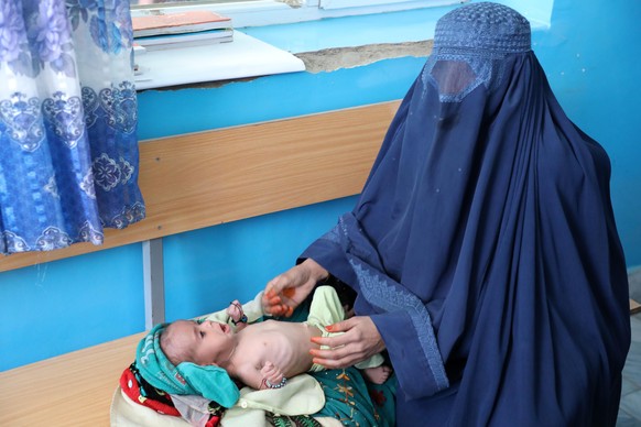 Ein unterernährtes Baby in einem Kabuler Krankenhaus.