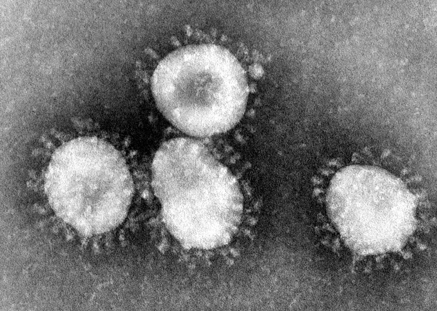 Die Ausbreitung einer mysteriösen Lungenkrankheit könnte auf einen neuartigen Coronavirus zurückgehen.