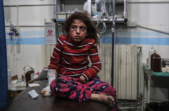 Die sechsjährige Kenana Yassin wartet auf ihre Behandlung, nachdem sie bei einem Luftangriff im Januar 2020 verletzt wurde.