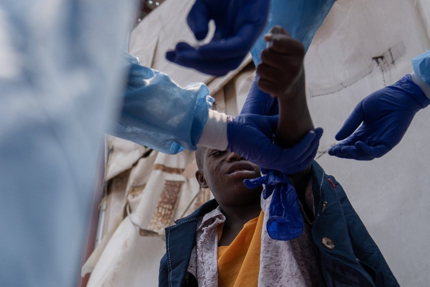 240820 -- GOMA, Aug. 20, 2024 -- A boy caught mpox gets treatment at a hospital on the outskirts of Goma, North Kivu province, eastern Democratic Republic of the Congo DRC, on Aug. 19, 2024. Roger Kam ...