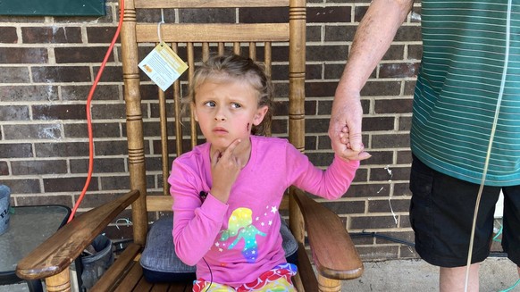 Syndication: Gaston Gazette Kinsley White, 6, shows reporters the wound a bullet left in her face. Kinsley White Gastonia NC , EDITORIAL USE ONLY PUBLICATIONxINxGERxSUIxAUTxONLY Copyright: xKaraxFohne ...