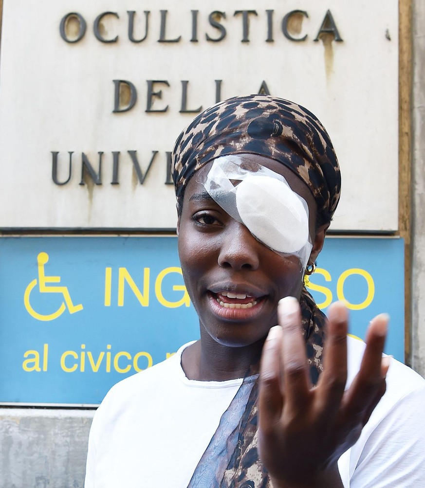 Discus thrower Daisy Osakue talks with reporters outside a hospital in Turin, Italy, Monday, July, 30 2018. The 22-year-old Osakue risks missing the European Athletics Championships after being hit in ...