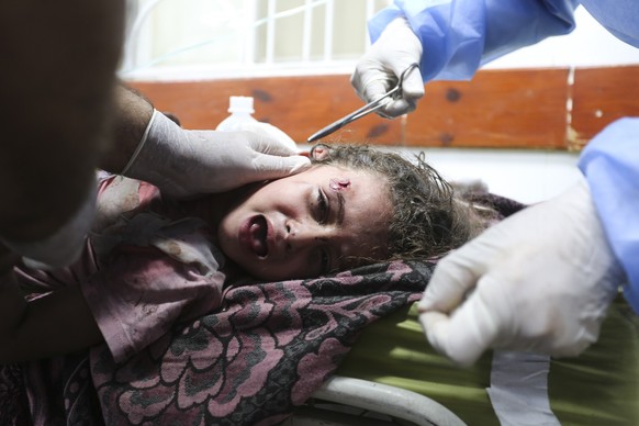 A Palestinian girl wounded in an Israeli strike on the Gaza Strip is treated in a hospital in Rafah on Monday, Oct. 30, 2023. (AP Photo/Hatem Ali)