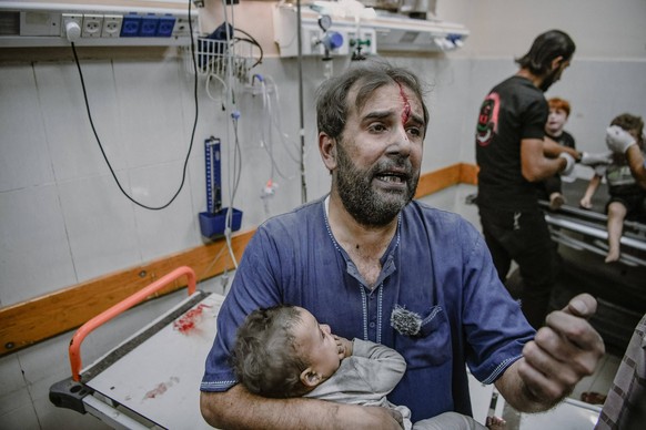 Israeli Strikes Hit Civilians In Khan Yunis Injured Palestinian children at Nasser Hospital in Khan Yunis, located in the southern Gaza Strip, following an Israeli airstrike on October 17, 2023. Khan  ...