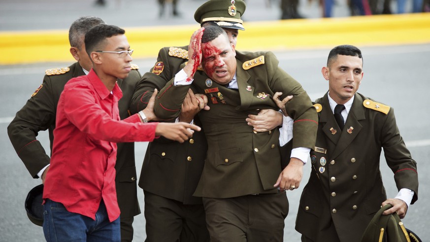 In this photo released by China's Xinhua News Agency, an uniformed official bleeds from the head following an incident during a speech by Venezuela's President Nicolas Maduro in Caracas, Venezuela, Sa ...