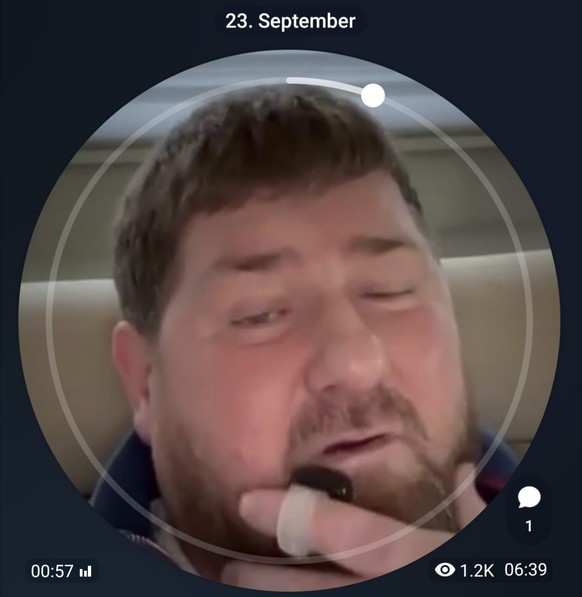 Auf mehreren Aufnahmen ist das Plastikgerät am Finger von Kadyrow zu sehen.