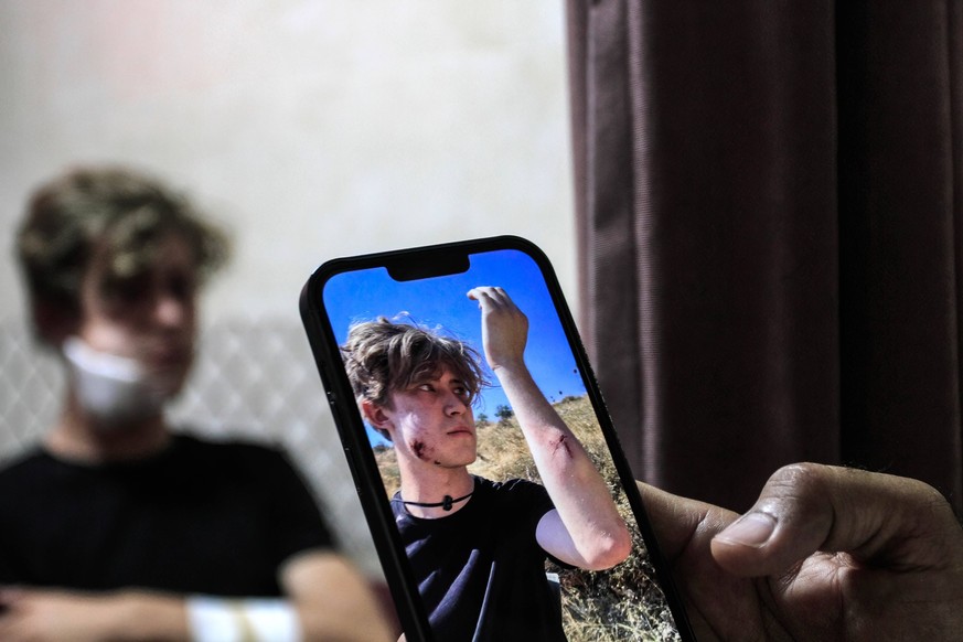 July 21, 2024, Nablus, West Bank, Palestine: A foreign volunteer shows a picture of himself bleeding from his phone, while receiving treatment at the Palestinian Rafidia Hospital in the city of Nablus ...